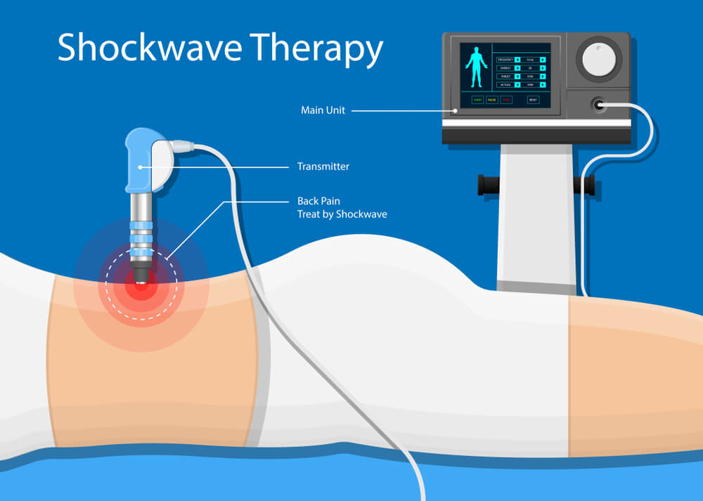 Shockwave therapy in Mississauga