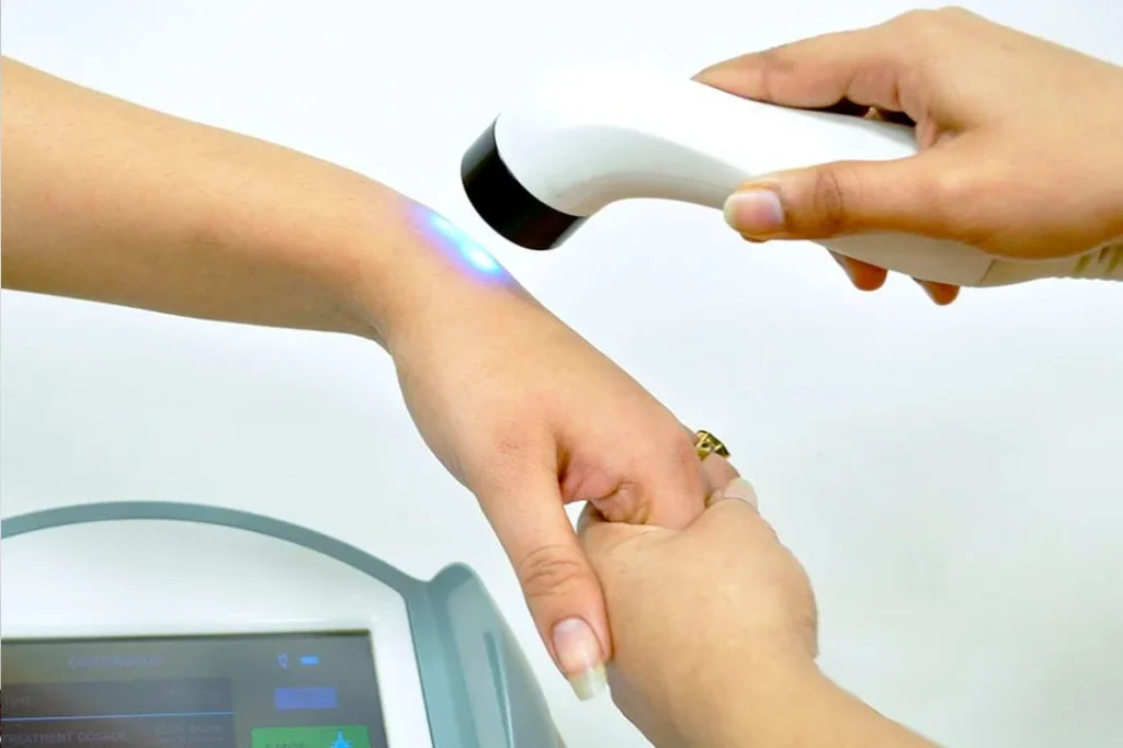 Laser Therapy